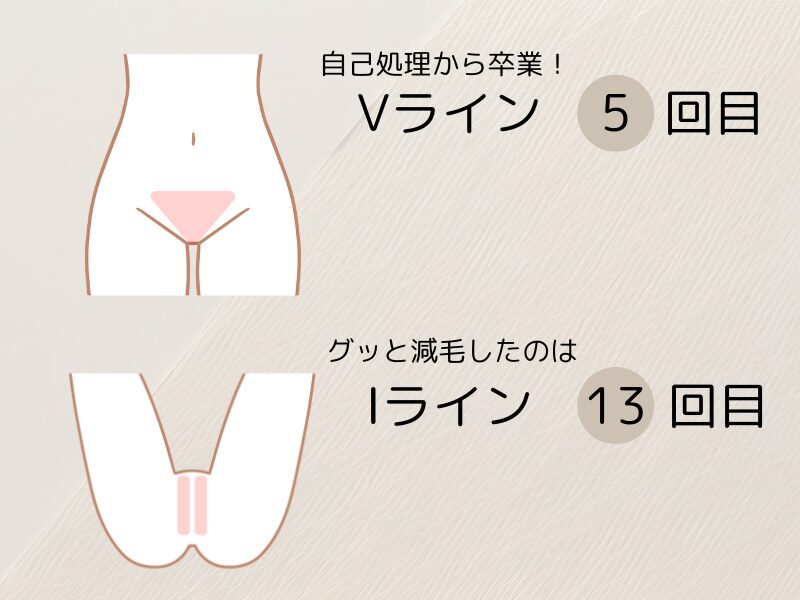 ケノンVIO脱毛はVライン5回目、Iライン13回目から効果を実感したことを表すイラスト