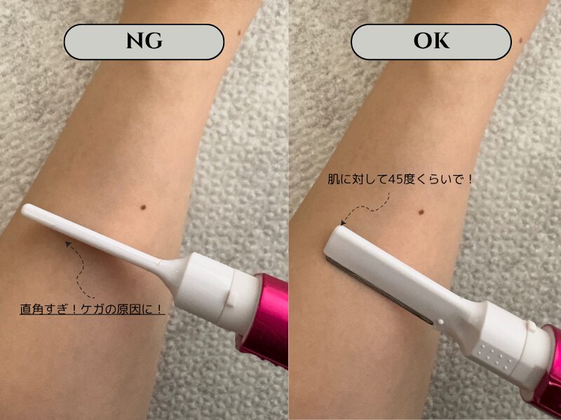 ケノンで脱毛するときのシェービングで気を付けるべき、電気シェーバーの角度のNG・OK比較画像