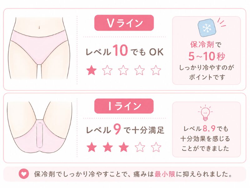 ケノンVIO脱毛の痛みの体感図解