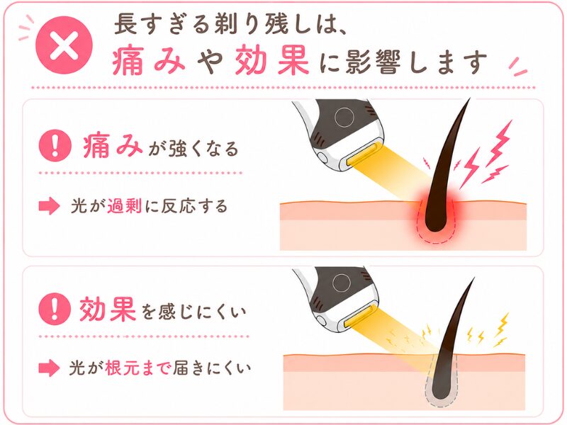 元カウンセラーママ】ケノンVIO脱毛は何回で効果出る？レベルは？