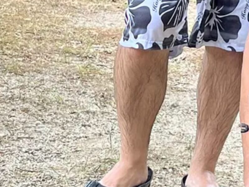 脱毛前海パン姿の夫の写真