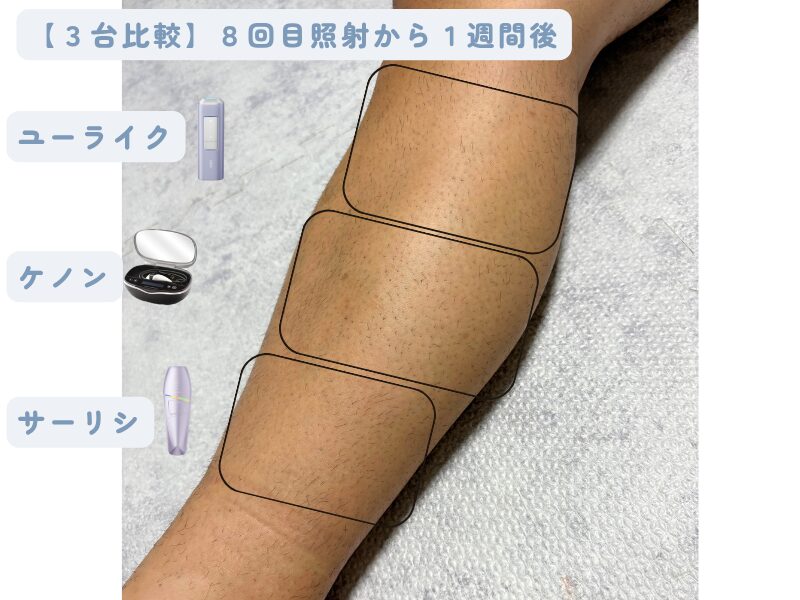 実際に３台の家庭用脱毛器を当てた夫のすね毛の状態写真