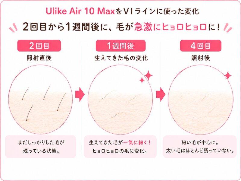 UlikeAir10MAXをVIラインに使った変化図解