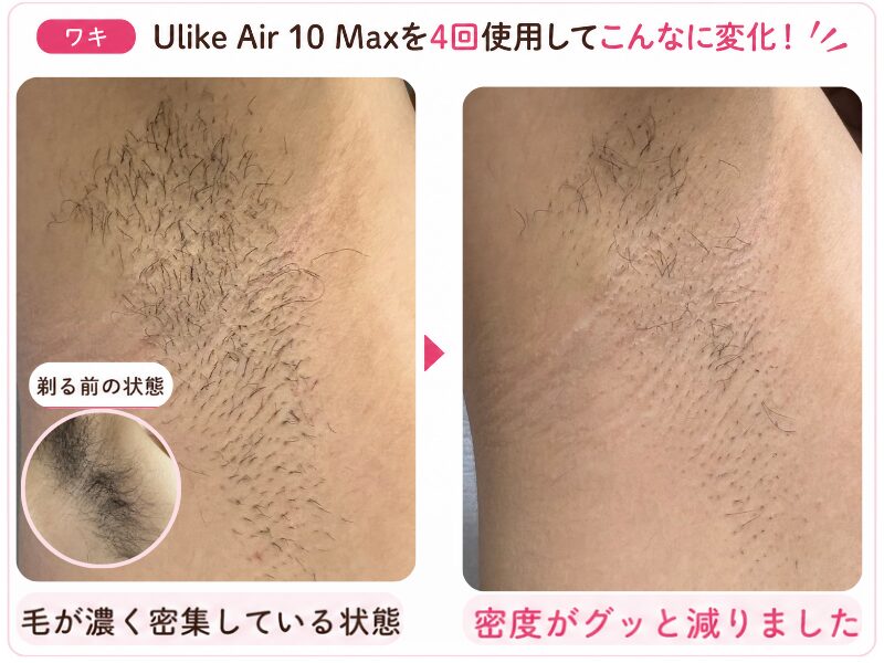 UlikeAir10MAXをワキに使った変化の図解